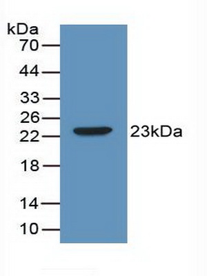 38817