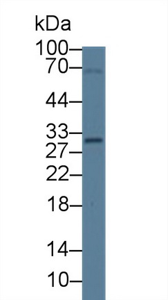 14175