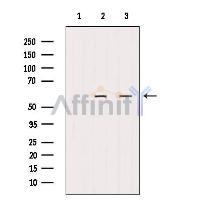 Валидация Affinity AF6033 - 3235