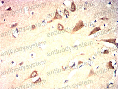 Валидация AntibodySystem RHF84201 (2695)