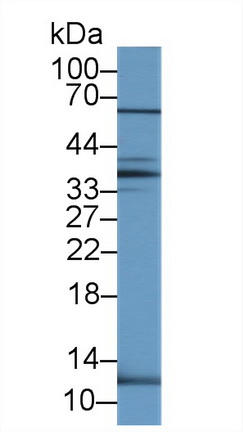 14435