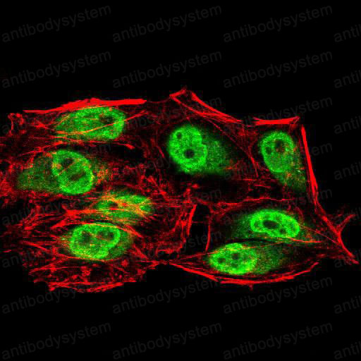 Валидация IF - AntibodySystem RHJ22903