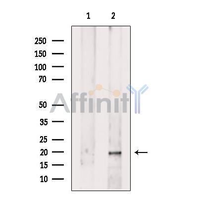 Валидация Affinity DF12240 - 6545