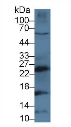 9374