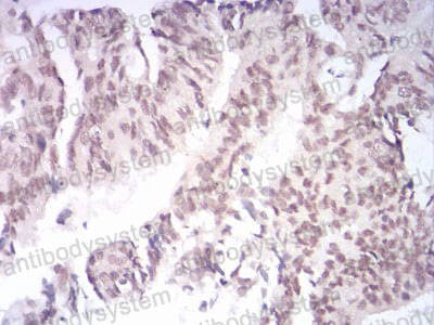 Валидация AntibodySystem RHN94701