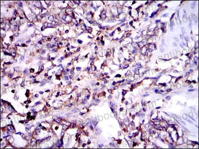 Валидация AntibodySystem RHC88403 (1155)