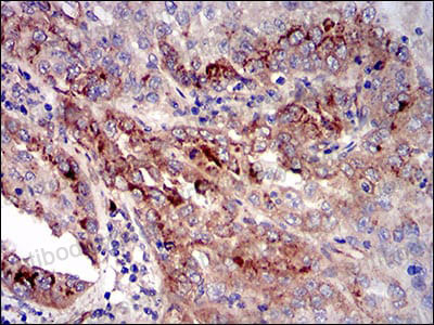 Валидация AntibodySystem RHH25203