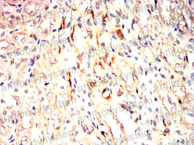 Валидация AntibodySystem RHN05102