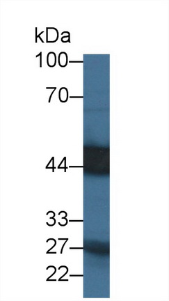14308