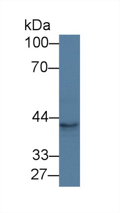 12725