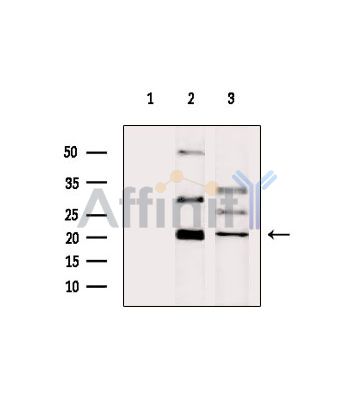 Валидация Affinity DF15077 - 11316
