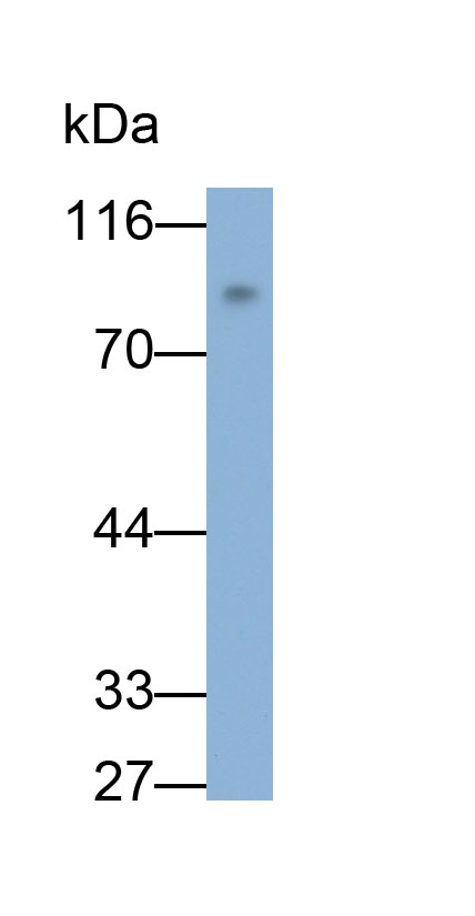 32571
