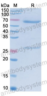 Валидация SDS-PAGE - AntibodySystem FMJ93240