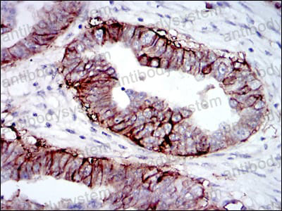 Валидация AntibodySystem RHC29906 (862)