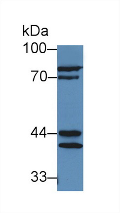 12970