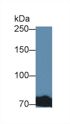 12575