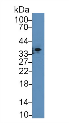 12911