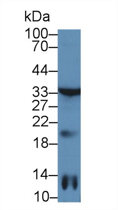 12962