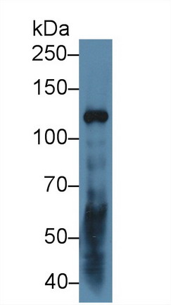 12990