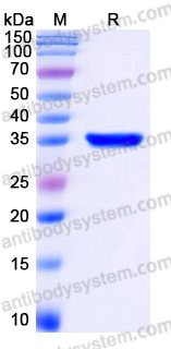 YHH38905, SDS-PAGE