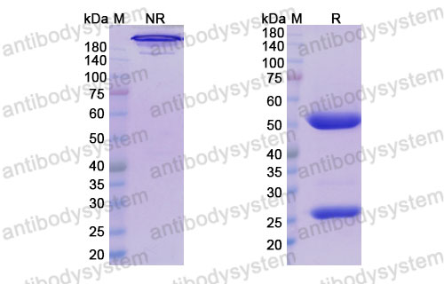 Валидация SDS-PAGE - AntibodySystem DHG17603