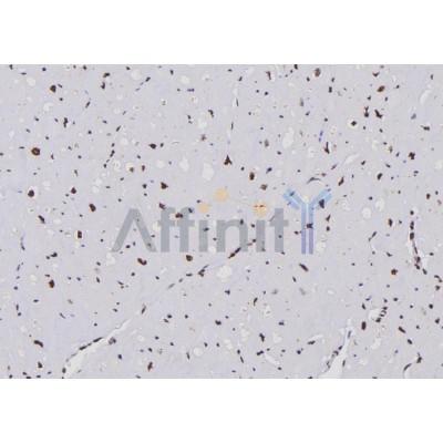 Валидация Affinity DF6418 - 17786