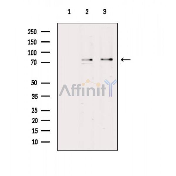 Валидация Affinity DF6472 - 17861