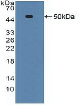 46911