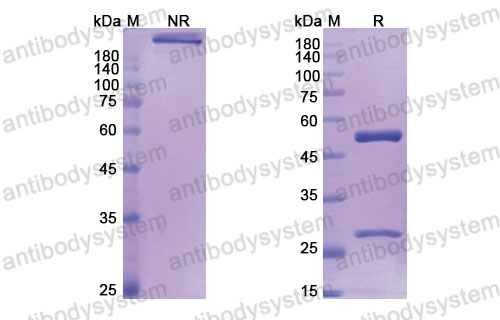 Валидация SDS-PAGE - AntibodySystem DHB96301