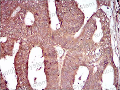 Валидация AntibodySystem RHJ63901 (3488)