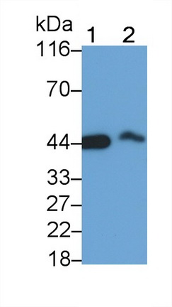64335
