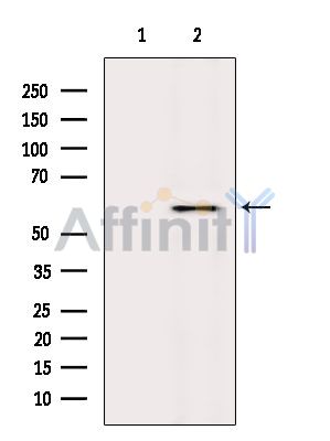 Валидация Affinity DF3578 - 14532