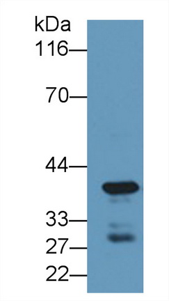 6245