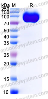 AHD33101, SDS-PAGE