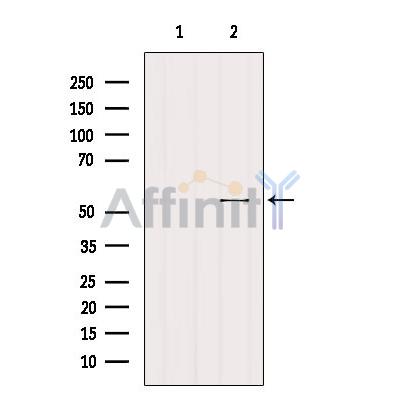 Валидация Affinity DF8776 - 20808