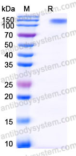 EHD15102, SDS-PAGE