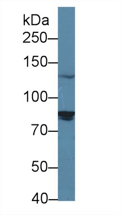 14035