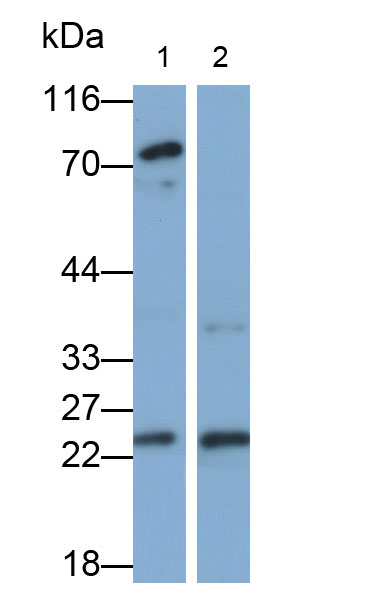 31675