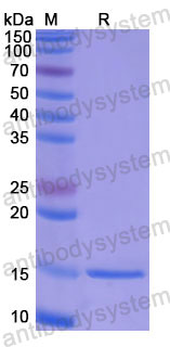 Валидация SDS-PAGE - AntibodySystem RHF11201