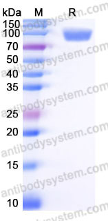 EHB96101, SDS-PAGE