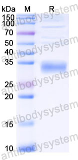 EHC71102, SDS-PAGE
