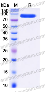 EHJ65303, SDS-PAGE