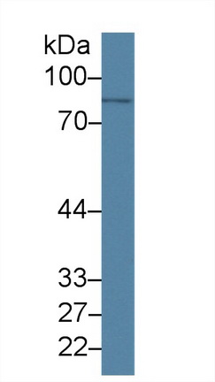 14701