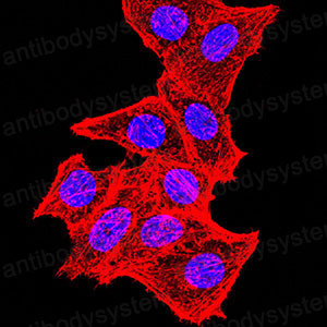 Валидация IF - AntibodySystem RHC88301 (455)