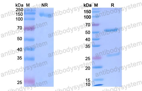 Валидация SDS-PAGE - AntibodySystem DHD72502