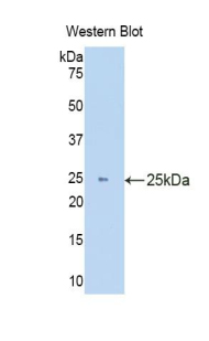 39535