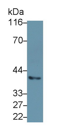 26085
