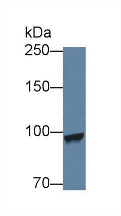 8911