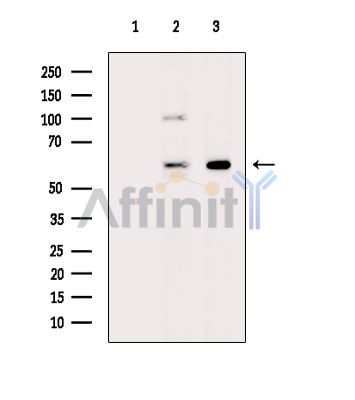 Валидация Affinity DF14917 - 11085