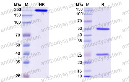 Валидация SDS-PAGE - AntibodySystem RMJ92802